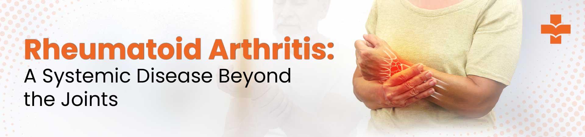 Rheumatoid Arthritis: A Systemic Disease Beyond The Joints