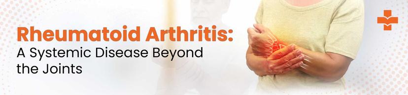 Rheumatoid arthritis affecting joints and internal organs