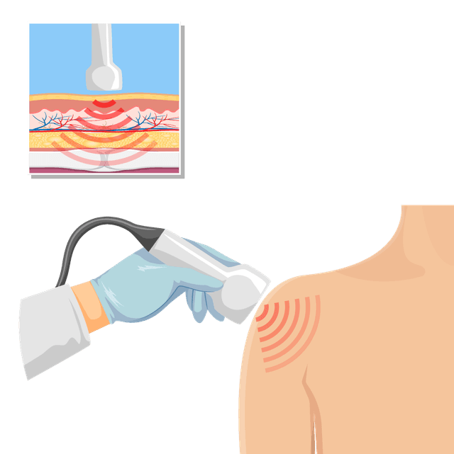 Musculoskeletal Ultrasound