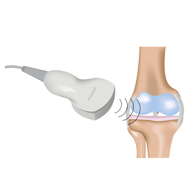 Musculoskeletal Ultrasound
