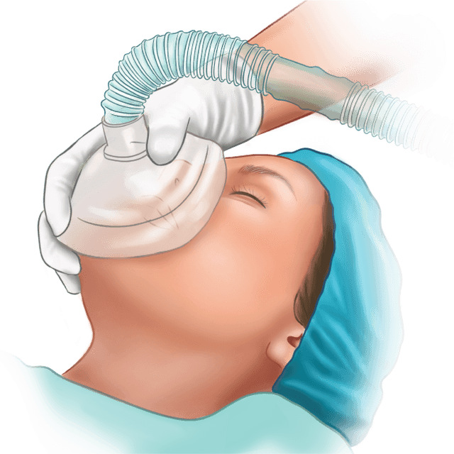 Anaesthesia