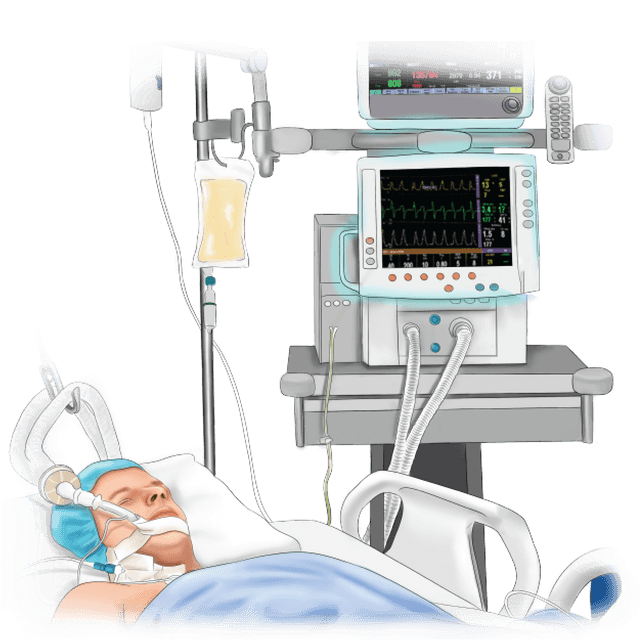Intensive Care Medicine