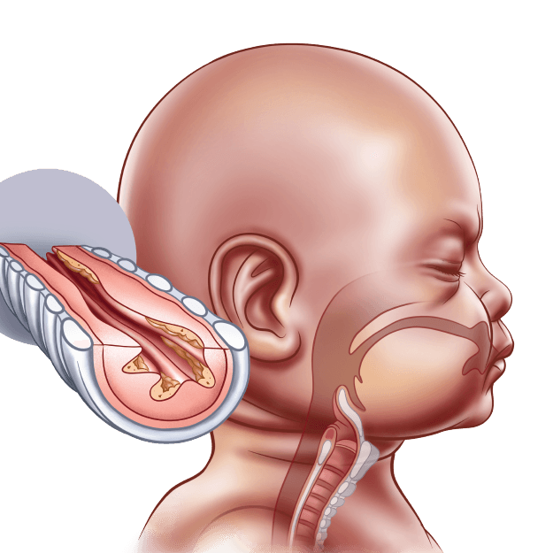 Advanced Certificate in Pediatrics