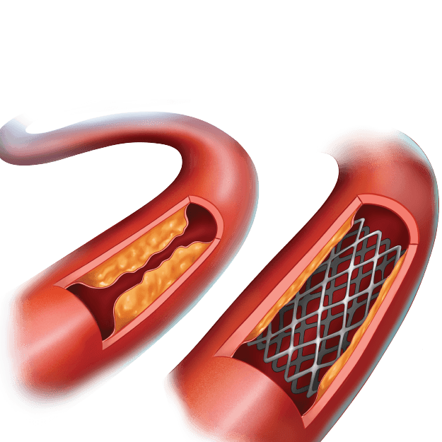 Certificate Course in Cardiac Emergencies