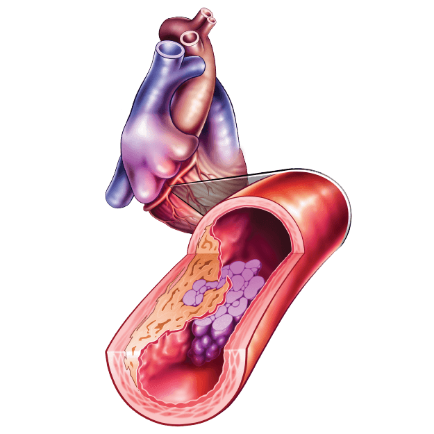 Clinical Preventive and Noninvasive Cardiology