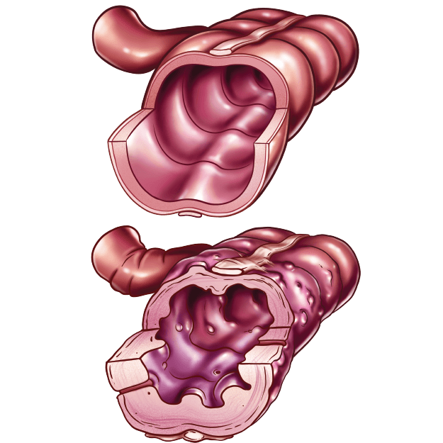 Gastroenterology