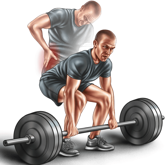 Sports Rehabilitation